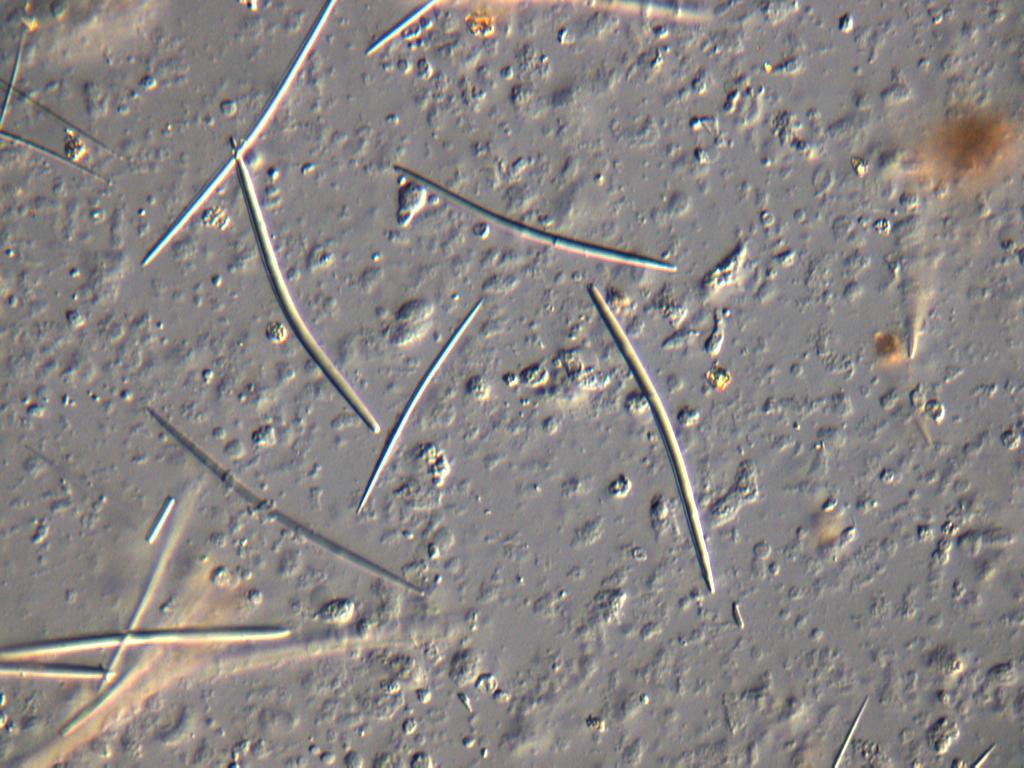 Haliclona sp. Claudia Tay